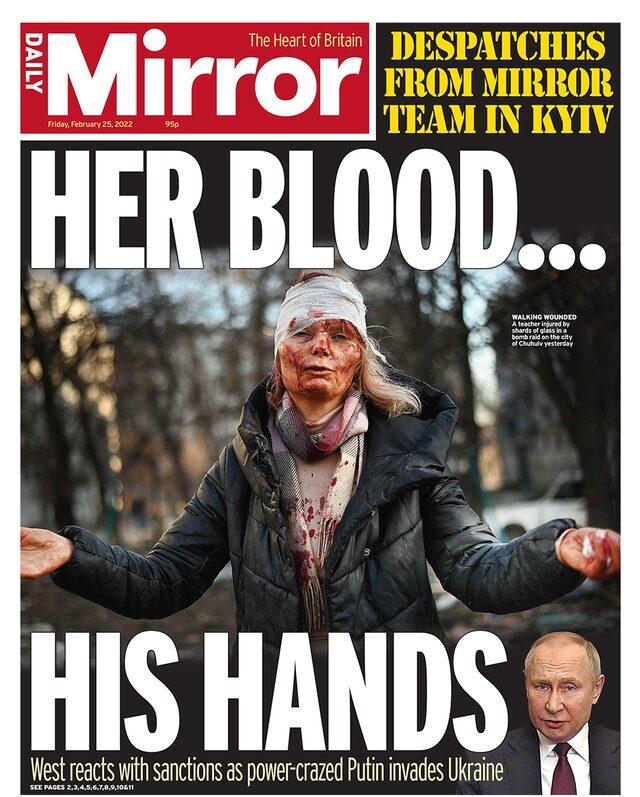 Daily Mirror gazetesi de yaralanmış kadının ellerini iki yana açmış fotoğrafının hemen altına, 
