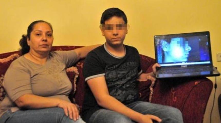 Parmak izleri y&uuml;z&uuml;nde &ccedil;ıktı