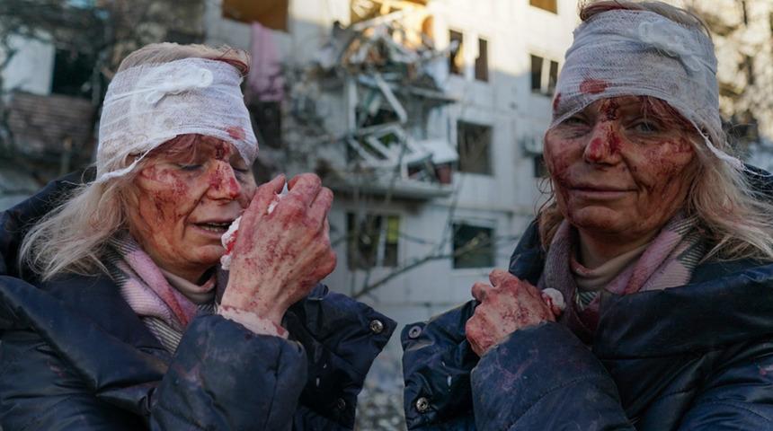 Rusya-Ukrayna savaşının simgesi oldu! Anlattıkları kan dondurdu