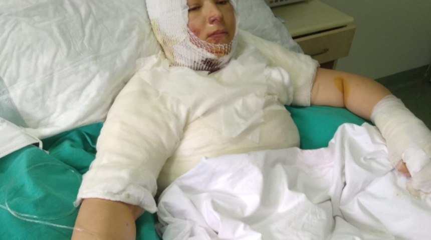 Ordu'da eski eşi Elvan'ı ateşe verip yanışını izledi! Kan donduran sözler: Gel gelinini yaktım