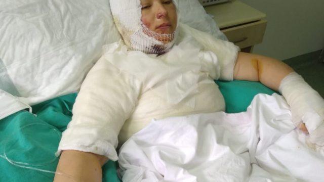 Ordu'da eski eşi Elvan'ı ateşe verip yanışını izledi! Kan donduran sözler: Gel gelinini yaktım