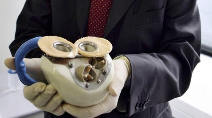 Yapay kalp 75 g&uuml;n sonra durdu