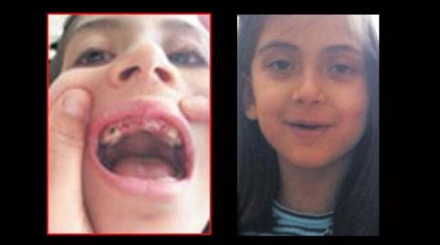 Bademcik ameliyatına girdi, dişsiz &ccedil;ıktı