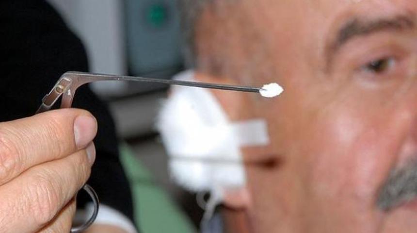 Sigara kağıdıyla kulak zarı tedavisi