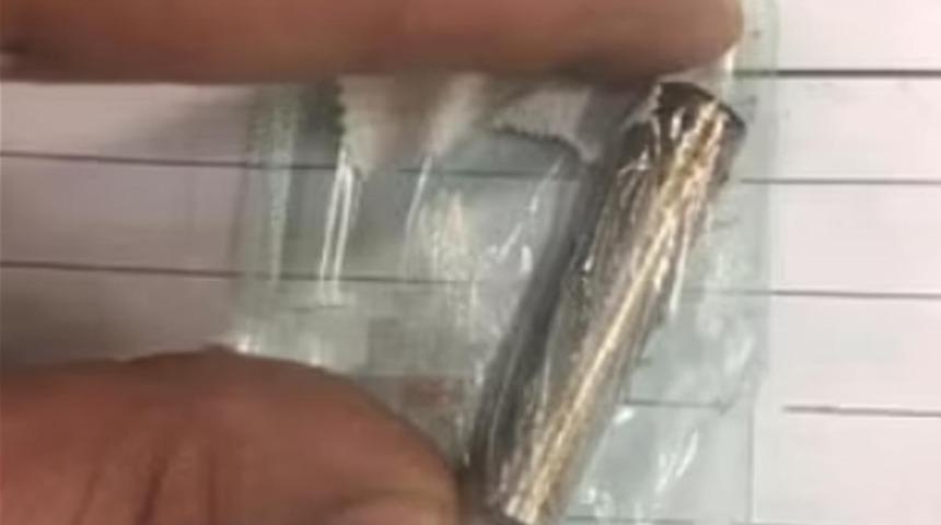 24 saat öyle bekledi: Cinsel organından çıkan şaşkınlık yarattı!