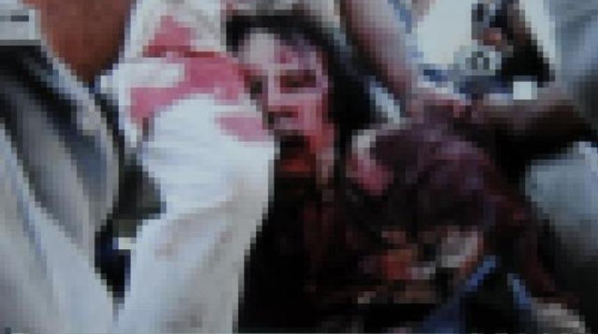 'Ölmedi, hâlâ yaşıyor'