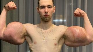 “Temel Reis” lakaplı Rus adam sosyal medyanın gündemine oturdu! Hayranları tıbbi destek almaya çağırdı