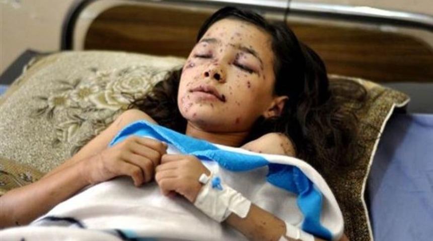 İsrail saldırısından sonra gözlerini açamadı