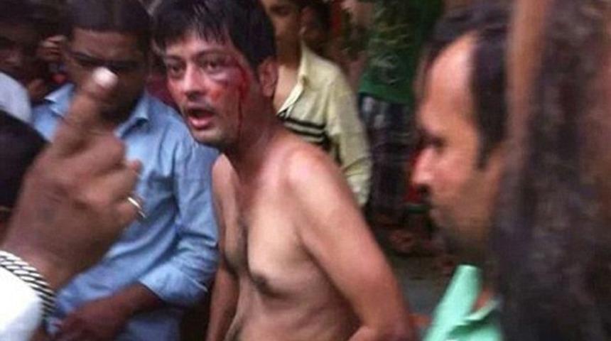 Tecav&uuml;zc&uuml;y&uuml; yakalayıp satırla penisini kestiler