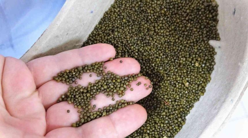 Bu kadarı da olamaz dedirtti: Safra kesesinden çıkanlar…