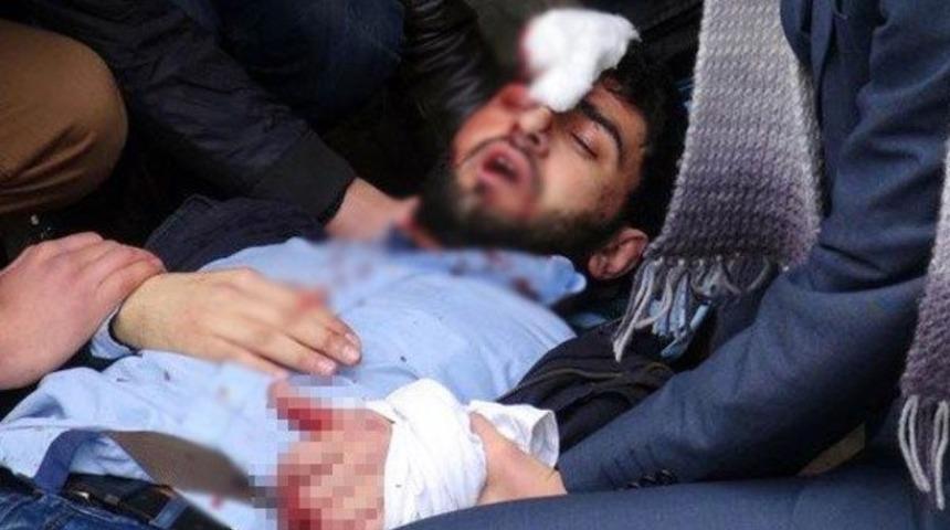 Kadıköy'de üniversiteliye satırlı saldırı