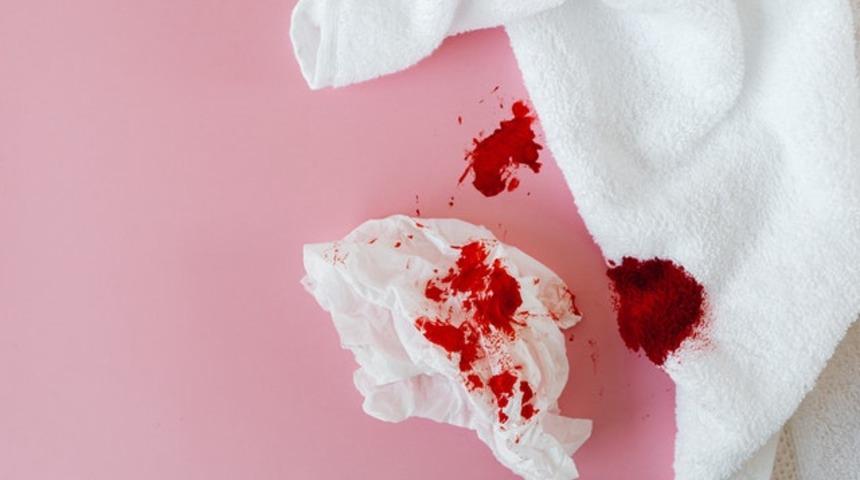 Kan lekeleri başınıza dert olmasın! Zahmetsiz bir şekilde kan lekelerini &ccedil;ıkaracak doğal y&ouml;ntemler sizlerle...