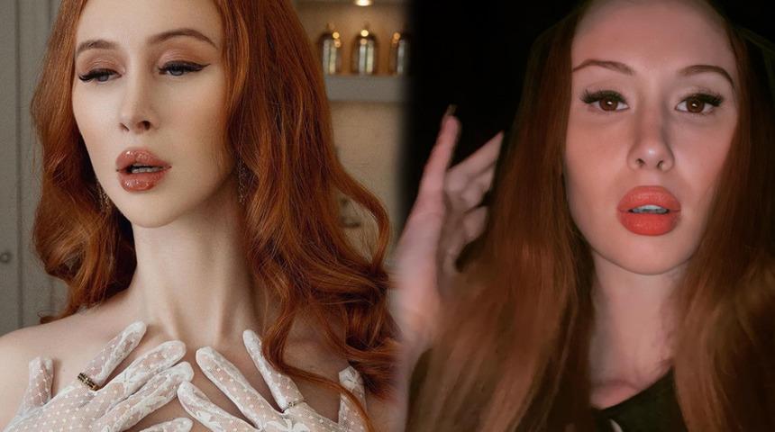 Dış görüntüsüyle alay ediyorlardı! Estetik ameliyatlarından sonra herkes onu konuşmaya başladı