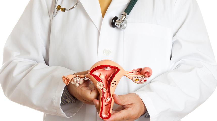 Dikkat! Miyomlar kansere dönüşebilir 