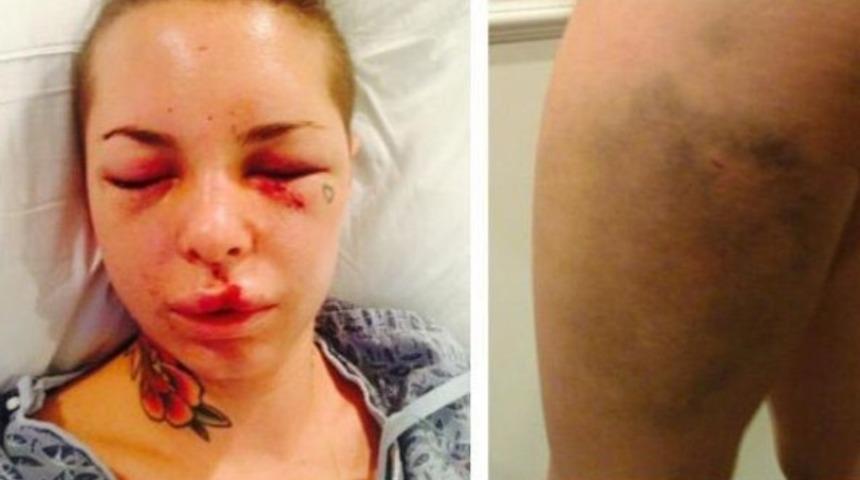 Eski sevgiliden, ünlü yıldız Christy Mack'e feci dayak