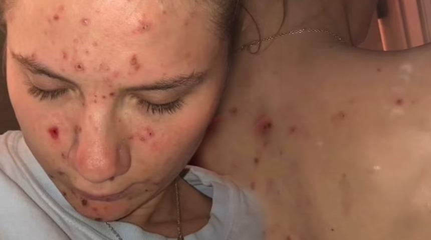 Takıntısı yüzünden bu hale geldi! Korkunç hastalığı yıllarca fark edemedi