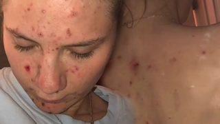 Takıntısı yüzünden bu hale geldi! Korkunç hastalığı yıllarca fark edemedi