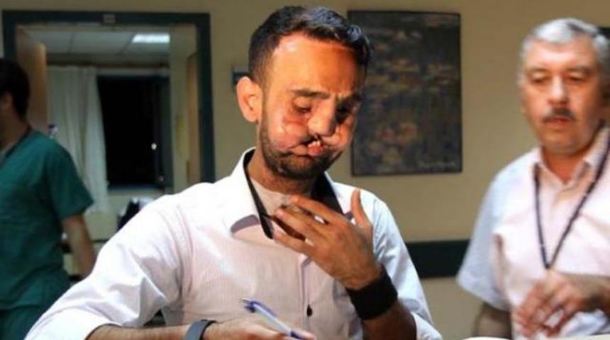 Yüz naklinde 'Tuz' kaygısı!