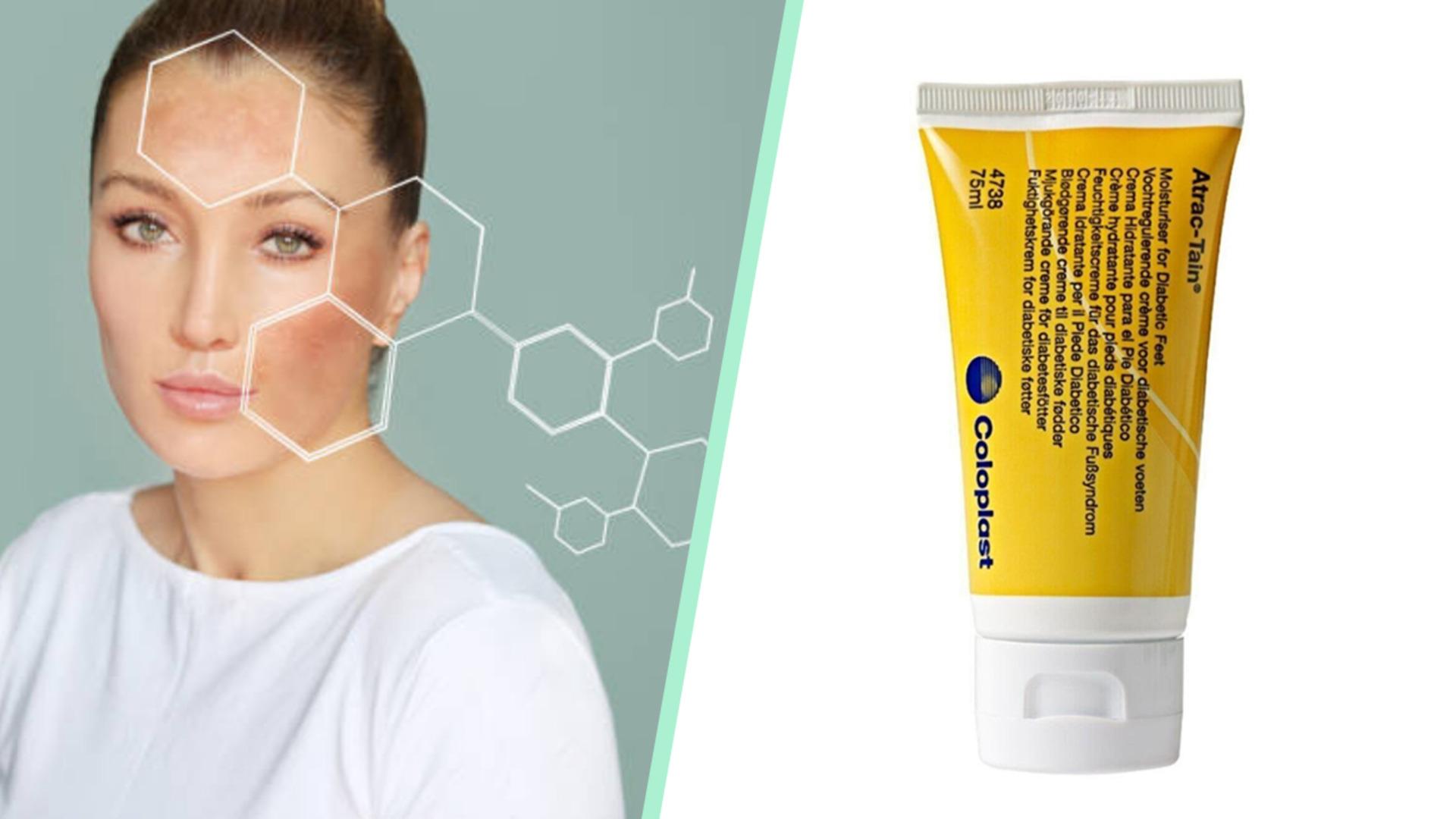 İz bırakmayan ve hızlıca iyileştiren en iyi yara kremi