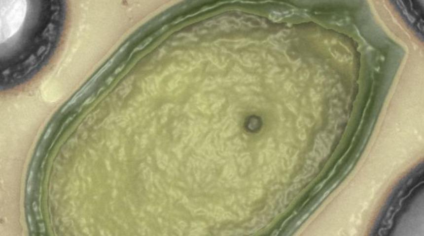 En b&uuml;y&uuml;k vir&uuml;s keşfi