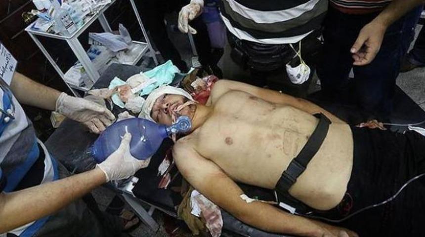 Mısır'da darbe karşıtlarına saldırı: 2 &ouml;l&uuml;