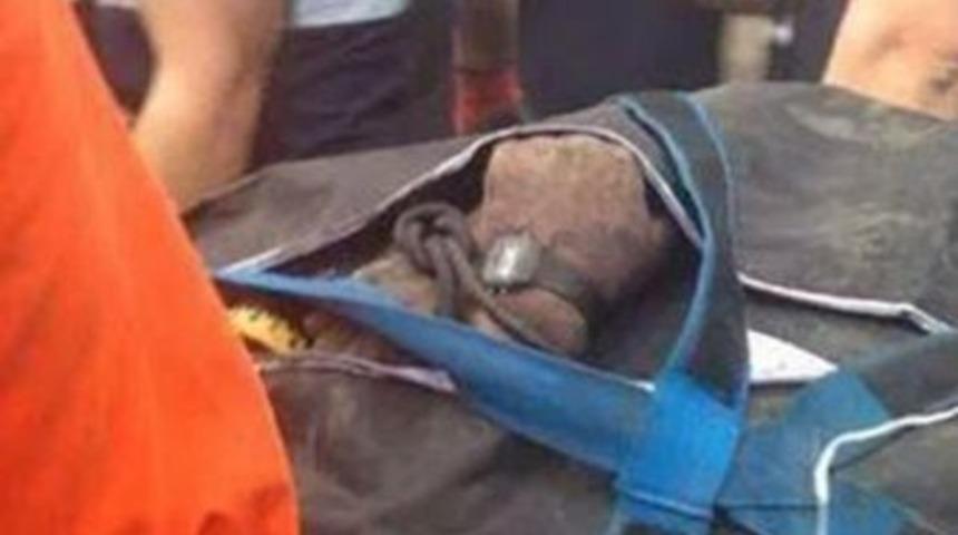 Madende göz göre göre ölüm