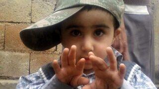 Muhammed iğne vurulduktan 1 gün sonra öldü