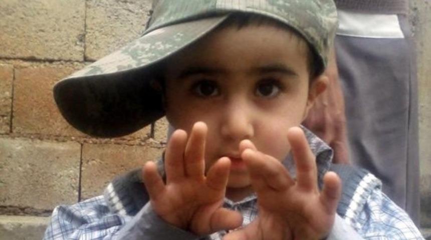 Muhammed iğne vurulduktan 1 gün sonra öldü