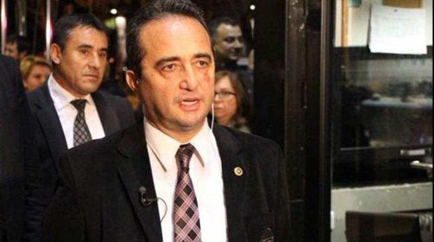 CHP Aydın Milletvekili Bülent Tezcan'a 3 gün işgöremezlik raporu
