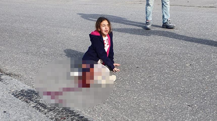 Köpekten kaçarken kâbusu yaşadı! Küçük Mahra için kritik saatler
