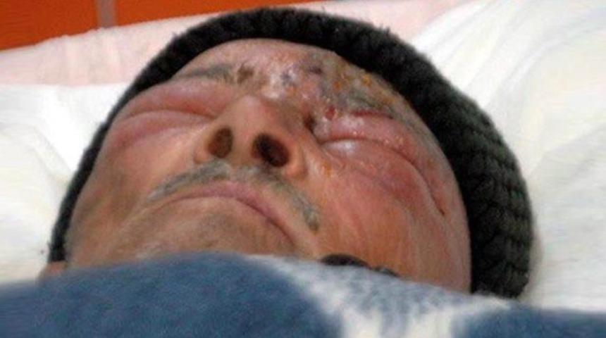 Sahte dişçi hastanelik etti