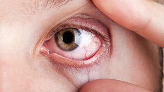 Uzmanlar uyarıyor: Belirti göstermiyor ve körlüğe neden olabiliyor…