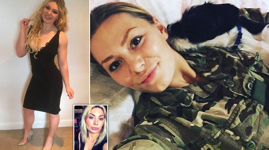 İngiliz askeri dudaklarına estetik yaptırınca eleştirilerin hedefi oldu! “Bu güvenlik tehdidi...”