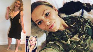 İngiliz askeri dudaklarına estetik yaptırınca eleştirilerin hedefi oldu! “Bu güvenlik tehdidi...”