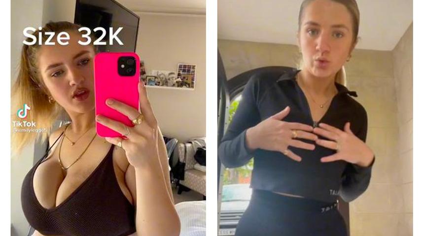 Estetik ameliyatları başına bela oldu! Binlerce sterlin harcadı, yeni halini görenler tanıyamadı