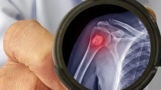 Bu şikayetler ihmale gelmez! Sinyaller risk altında olduğunuzu gösteriyor