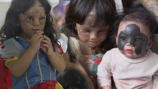 Doğduğu günden beri çare arıyor! Tedaviye başladılar ama bu sefer de...