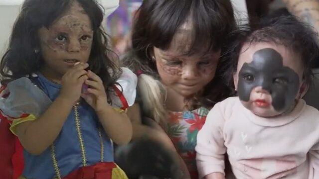 Doğduğu günden beri çare arıyor! Tedaviye başladılar ama bu sefer de...