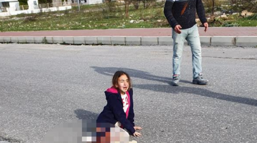 Köpekten kaçarken kamyon ezmişti! Bacağı kesilen Mahra'nın kalbi 10 dakika durdu... Kahreden anları acılı baba böyle anlattı