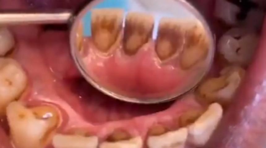 Nasıl olduğunu göstermek için korkunç gerçeği gözler önüne serdi