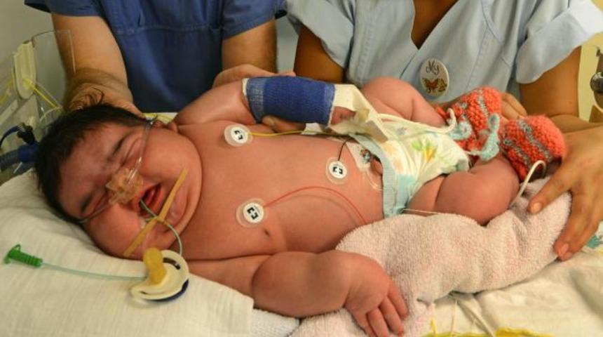 Almanya'nın en şişman bebeği