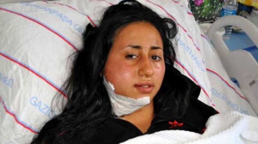 Dişi apse yaptı sandı ama...