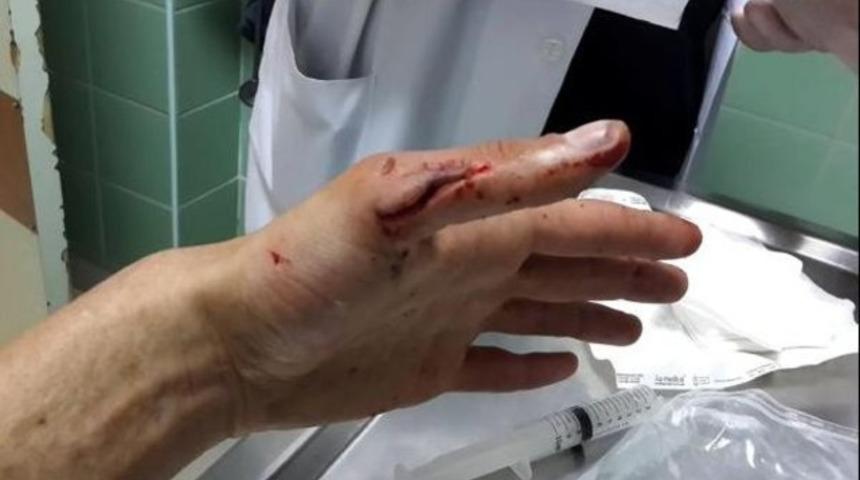 Ankara B&uuml;y&uuml;kşehir Belediyesi'nden CHP'li gen&ccedil;lere palalı saldırı iddiası