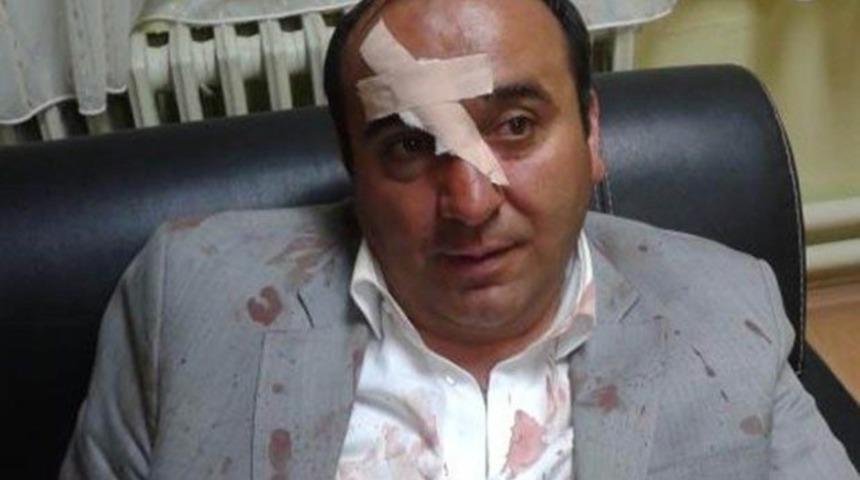 AK Partili Belediye Başkanı saldırıya uğradı