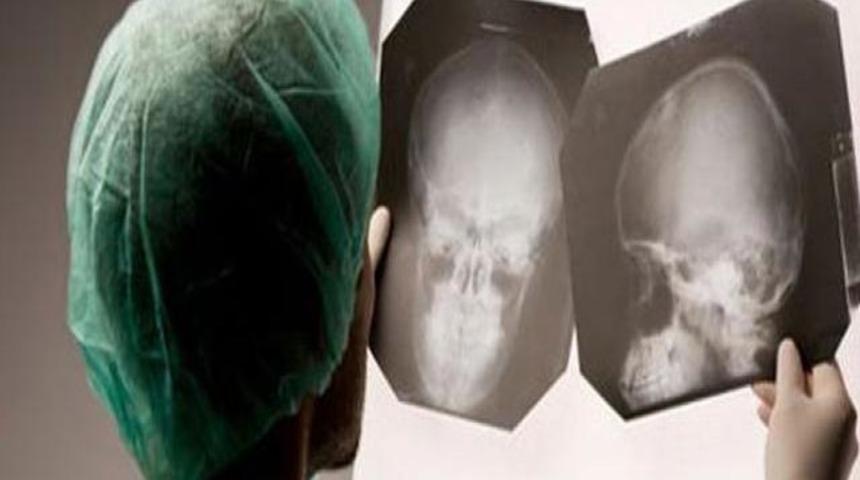 Kafaya darbe IQ'yu düşürüyor