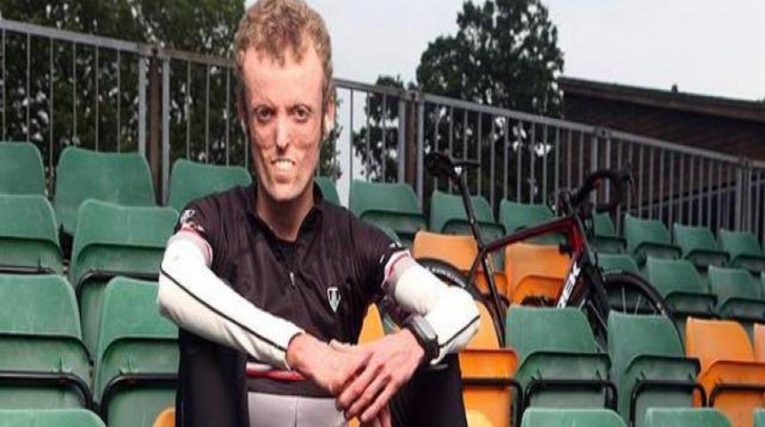 12 yaşından beri eriyor