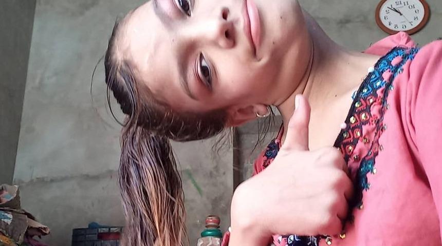 Mucizevi operasyon! Kafasını dik tutamıyordu: Bana yeni bir hayat...