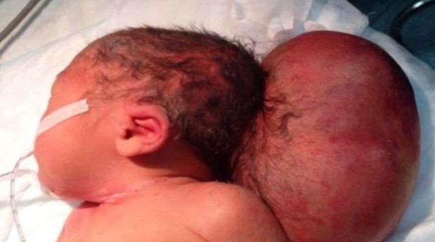 Dünyaya böyle geldi