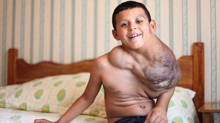 Küçük Jose Serrano'nin iyileşme umudu Viagra