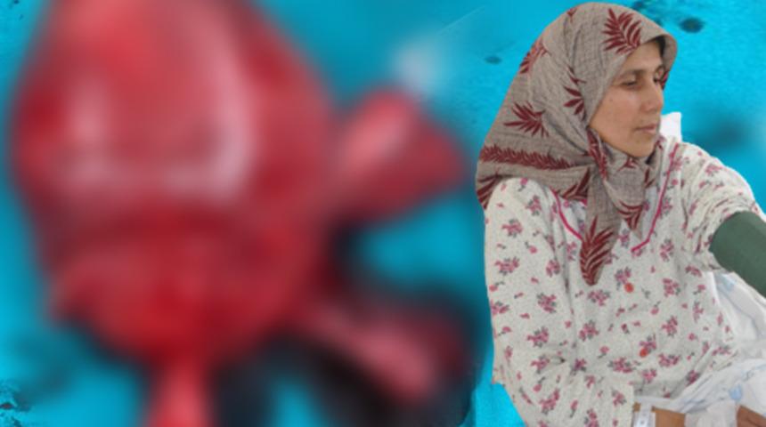 Karın ağrısı şikayetiyle gitti, 40 santimetre 5  kiloluk kitle çıkarıldı